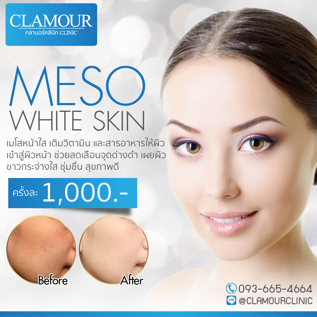 Meso White Skin